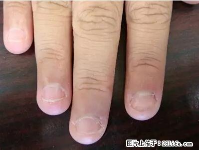 剪指甲、挖耳屎，这些日常小动作竟隐藏大危害！ - 南昌生活资讯 - 南昌28生活网 nc.28life.net